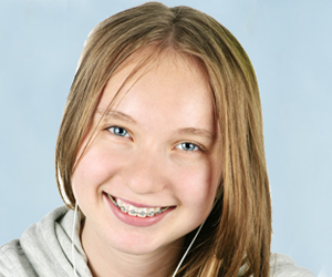 Facts about braces for kids